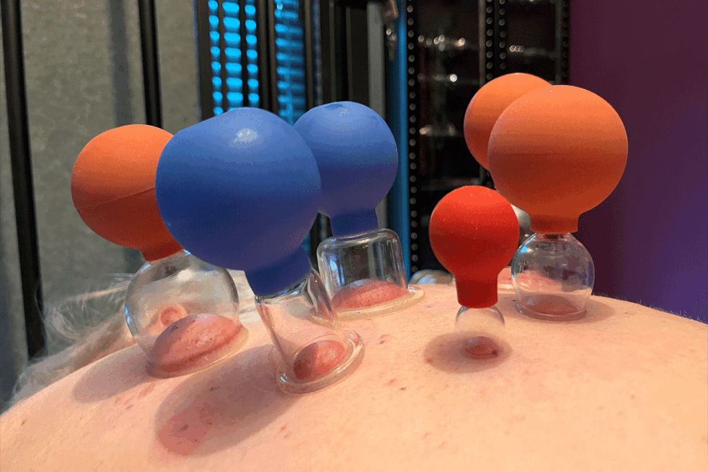 Cupping en BDSM